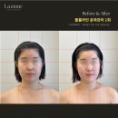 라즈뮤에스테틱 | 병점 퍼스널 스킨 컨설팅 윤곽관리 대만족 후기 라즈뮤에스테틱