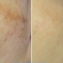 더퍼스트피부과의원 이미지