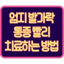 엄지+10 | 갑자기 왼쪽 엄지발가락 통증 치료 공개!(ft.5주 후기)