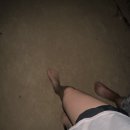 pet38라6637 | 45. 림프종(DLBCL)_치료 종료 후 추적검사 및 결과 / 방글이의 여름방학