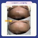 뷰티온니(beauty only) | 다산 왁싱 고민이라면? 피부관리까지 가능한 스킨플래닝