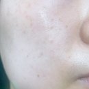 뽑기 박스 이미지