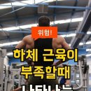 하체 근육이 부족할 때 나타나는 5가지 증상! 이미지