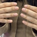 이렌 | 드디어 찾은 물어뜯는손톱 한번에 해결하는방법 - 대구아크릴연장전문 "람페로마" 물뜯손 교정 후기