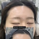 신수연헤어 | 대전 헤어라인 왁싱으로 교정?,왁싱만으로도이마가 봉긋해 보이는 효과,둔산동 헤어라인왁싱, 탄방동...
