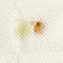 데이지동물병원 | 강아지 장염 설사, 혈변_확인사항, 주의사항, 동물병원 처치 후기, 관리, 회복 과정