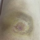 연세선마취통증의학과의원 네이버블로그