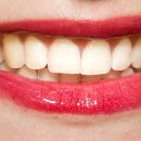 줌바피트니스댄스 A 이미지