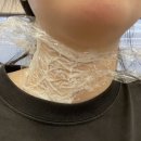 남양동5,6,7통통합 | [갑상선암 일기] 이샘병원 진료 · 초음파 및 세침검사 · 갑상선암 확진 · 외과 진료 · 입원 전 검사