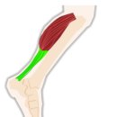 대치서울정형외과의원 이미지