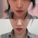 유명채널 | 해운대 에스테틱 작은 얼굴전문으으로 유명한 끌리메 센텀 후기