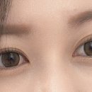 두눈아이청담 이미지