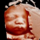 아시아드 메디칼 빌딩 이미지