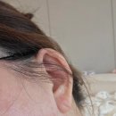 후한의원 | 부산CMC연산한의원 체질 검사후 후기