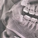 헤이사랑치과의원 이미지