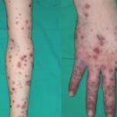 스페셜독 이미지