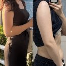 제일꼼꼼내과의원 | 신사역 다이어트주사 하프하게 팔뚝 바디관리 비만클리닉의원 '1주차 후기'