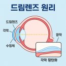 아이드림소프트(주) | 드림렌즈 원리와 부작용, 장점 단점 총정리 (사용 후기 및 가격)