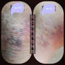 아기탄생조산원 | 꽁냥이의 아기탄생조산원 열린 출산 후기(산전출산산후통합테라피적용후기)