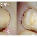 보일치과기공소 이미지