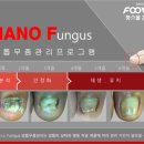 올케어 강남 티스토리