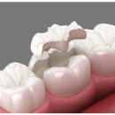 엔젤치과의원 이미지