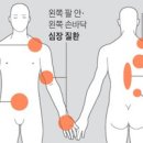 등 통증 뻐근하고 뭉친 느낌 등이 아플 때 이유 이미지