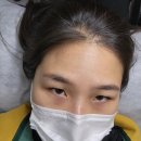 픽스칼프 이미지