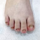 레푸스 앤 쓰담네일 이미지