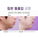 경주본치과의원 네이버블로그