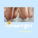 미제이뷰티 | 포천 송우리 토탈뷰티샵 미제이뷰티에서 발각질관리 후기 | 송우리패디플래닝 추천
