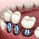 이바른치과의원 이미지