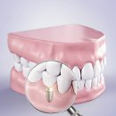 리체부부치과의원 이미지