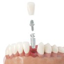탑연세치과병원 이미지