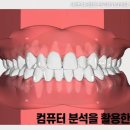 아로치과의원 네이버블로그