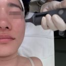 메일빈에코로마네시티점 | 전주 피부관리 모공이 고민이라면 스킨플라청담