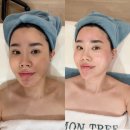 남천동 피부관리 예신관리 레몬트리에스테틱 솔직후기 (주차, 가격)
