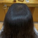 “토탈탈모교정펌 × 크리닉셋팅펌, 탈모·손상·볼륨을 한 번에 잡는 화려한 믹스매치의 정답” 이미지