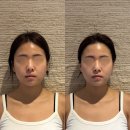 안산 피부관리 이로 에스테틱에서 초음파,고주파 관리 받은 후기
