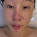 불당동 피부관리 메리진 수분관리 추천 후기