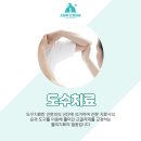 고릴라신경외과의원 네이버블로그
