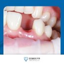 든든플란트치과의원 이미지