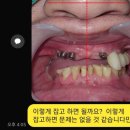 모델리스 치과기공소 이미지