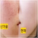 동백바른약국 | 비판텐 연고 가격 관리방법 후기