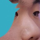 바바성형외과의원 이미지