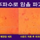 소리(Sound) 이미지