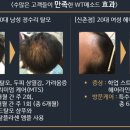 독일WT메소드