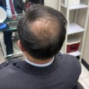 에이스모가발