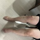 무릎보호대 추천, 테이핑테크 슬개건 보호대 운동할 때 사용 후기