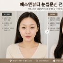 잰뷰티 | 대구 두류역 눈썹문신 잘하는곳 에스엔뷰티 시술후기
